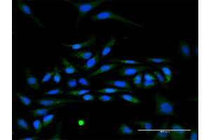 Immunofluorescence of purified MaxPab antibody to IFNA17 on HeLa cell.