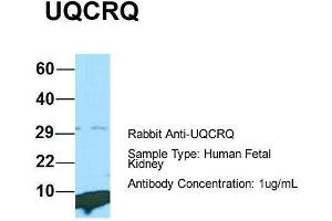 Host: Rabbit  Target Name: UQCRQ  Sample Tissue: Human Fetal Kidney  Antibody Dilution: 1. (UQCRQ antibody  (Middle Region))