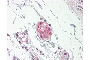 Anti-NOS1 / nNOS antibody IHC staining of human small intestine, submucosal plexus. (NOS1 antibody  (N-Term))
