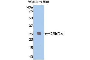 Western Blotting (WB) image for anti-B-Cell CLL/lymphoma 2 (BCL2) (AA 2-208) antibody (ABIN1858119)