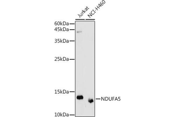 NDUFA5 抗体  (AA 1-116)