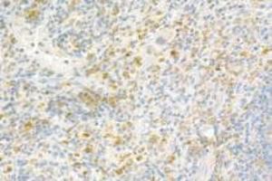 Immunohistochemistry analysis of paraffin-embedded rat spleen using,Resistin (ABIN7075402) at dilution of 1: 800 (Resistin antibody)