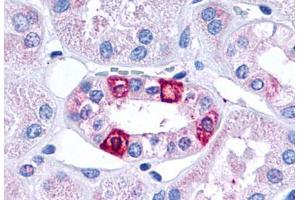 Anti-5HT1F Receptor antibody  ABIN1048264 IHC staining of human kidney, renal tubules.