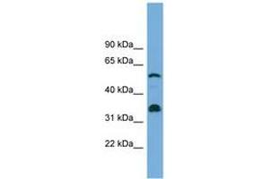 Image no. 1 for anti-Cytochrome P450, Family 26, Subfamily B, Polypeptide 1 (CYP26B1) (C-Term) antibody (ABIN6744176) (CYP26B1 antibody  (C-Term))