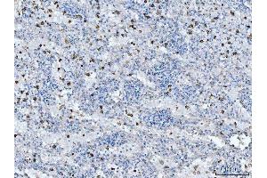 IHC analysis of CD14 using anti-CD14 antibody (ABIN7600531). (CD14 antibody  (AA 20-259))