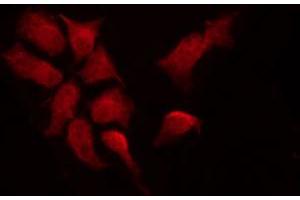 ABIN6267533 staining A2780 by IF/ICC. (CDKN1B antibody  (pThr187))