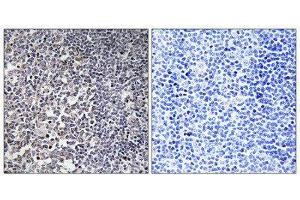 Immunohistochemistry (IHC) image for anti-Mitochondrial Ribosomal Protein S16 (MRPS16) (Internal Region) antibody (ABIN1850528) (MRPS16 antibody  (Internal Region))