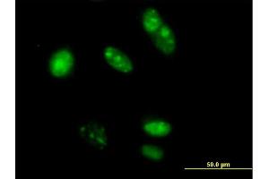 Immunofluorescence of purified MaxPab antibody to TRFP on HeLa cell. (MED20 antibody  (AA 1-212))