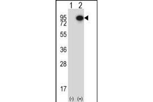 Western blot analysis of CTTN (arrow) using rabbit polyclonal CTTN Antibody (Center) (ABIN657649 and ABIN2846644). (Cortactin antibody  (AA 273-302))