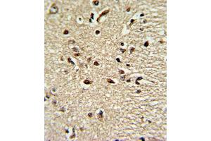 Formalin-fixed and raffin-embedded human brain tissue reacted with X4 Antibody (Center), which was peroxidase-conjugated to the secondary antibody, followed by DAB staining. (PAX4 antibody  (AA 171-200))