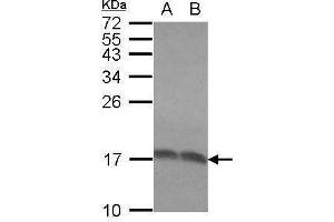 WB Image Sample (30 ug of whole cell lysate) A: Molt-4 B: Raji 15% SDS PAGE antibody diluted at 1:1000 (RPLP2 antibody  (Center))