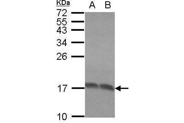 RPLP2 antibody  (Center)