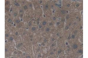 Detection of ALOX12 in Human Liver Tissue using Polyclonal Antibody to Arachidonate-12-Lipoxygenase (ALOX12) (ALOX12 antibody  (AA 352-656))