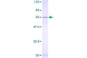 TDP-Glucose 4,6-Dehydratase (TGDS) (AA 1-350) protein (GST tag)