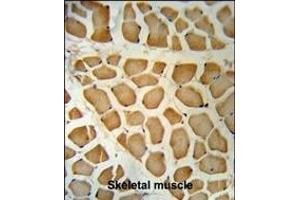 PSA Antibody (C-term) (ABIN390478 and ABIN2840843) IHC analysis in formalin fixed and paraffin embedded human Skeletal muscle followed by peroxidase conjugation of the secondary antibody and DAB staining. (Prostate Specific Antigen antibody  (C-Term))