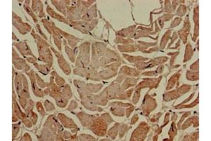 Immunohistochemistry of paraffin-embedded human heart tissue using ABIN7160165 at dilution of 1:100