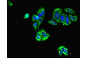 Immunofluorescent analysis of PC-3 cells using ABIN7153961 at dilution of 1:100 and Alexa Fluor 488-congugated AffiniPure Goat Anti-Rabbit IgG(H+L) (Glutamate Receptor 3 antibody  (AA 151-250))