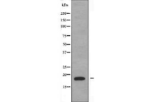 Western blot analysis of extracts from K562 cells, using PBOV1 antibody. (PBOV1 antibody  (Internal Region))
