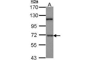 DYRK1B Antikörper  (N-Term)