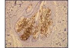 Immunohistochemistry (IHC) image for anti-Mucin 1 (MUC1) (C-Term) antibody (ABIN870418) (MUC1 antibody  (C-Term))