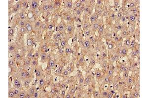 Immunohistochemistry of paraffin-embedded human liver tissue using ABIN7170002 at dilution of 1:100 (GLUT1 antibody  (AA 263-458))