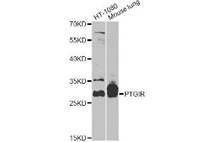 Western blot analysis of extracts of various cell lines, using PTGIR antibody (ABIN5970948) at 1/1000 dilution. (Prostacyclin Receptor antibody)