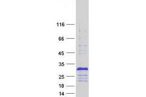 Western Blotting (WB) image for Cysteine-Rich Protein 2 (CRIP2) protein (Myc-DYKDDDDK Tag) (ABIN2712806)