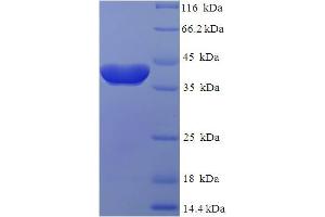 SDS-PAGE (SDS) image for RAB2A, Member RAS Oncogene Family (RAB2A) (AA 2-212) protein (His-SUMO Tag) (ABIN4974508)