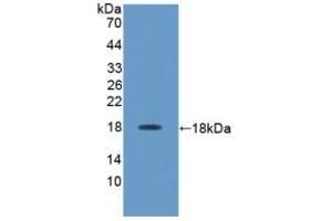 Detection of Recombinant IL17, Rat using Polyclonal Antibody to Interleukin 17 (IL17) (IL-17 antibody  (AA 18-150))