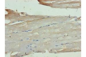 Immunohistochemistry of paraffin-embedded human skeletal muscle tissue using ABIN7163920 at dilution of 1:100