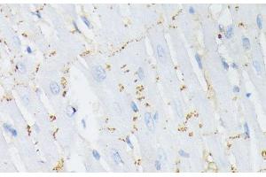 Immunohistochemistry of paraffin-embedded Rat heart using Phospho-GJA1(S368) Polyclonal Antibody at dilution of 1:200 (40x lens). (Connexin 43/GJA1 antibody  (pSer368))