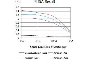 Black line: Control Antigen (100 ng),Purple line: Antigen (10 ng), Blue line: Antigen (50 ng), Red line:Antigen (100 ng) (CXCR2 antibody)