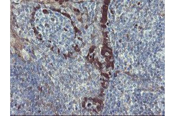 TSC22D1 antibody
