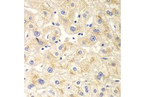 Immunohistochemistry of paraffin-embedded human liver injury using DNM1L antibody. (Dynamin 1-Like antibody)