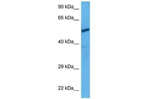 Host:  Rat  Target Name:  CHRNA3  Sample Tissue:  Rat Skeletal Muscle  Antibody Dilution:  1ug/ml (CHRNA3 antibody  (N-Term))