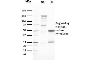 SDS-PAGE Analysis Purified GATA-3 Mouse Monoclonal Antibody (GATA3/2446). (GATA3 antibody  (AA 357-436))