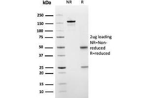 SDS-PAGE Analysis Purified PAI-RBP1 Mouse Monoclonal Antibody (SERBP1/3498). (SERBP1 antibody  (AA 3-139))