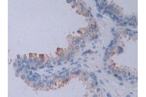 IHC-P analysis of Human Prostate Tissue, with DAB staining.