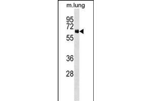 NET1 Antibody (Center) (ABIN1538140 and ABIN2849003) western blot analysis in mouse lung tissue lysates (35 μg/lane).