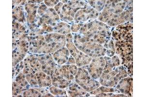 Immunohistochemical staining of paraffin-embedded Kidney tissue using anti-LIPG mouse monoclonal antibody. (LIPG antibody)