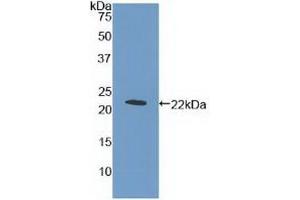 Detection of Recombinant MPL, Human using Polyclonal Antibody to Thrombopoietin Receptor (TPOR) (MPL antibody  (AA 311-460))