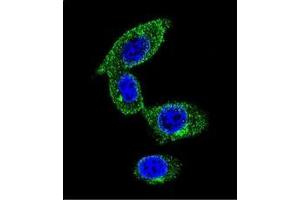 Confocal immunofluorescent analysis of SORBS1 / Ponsinin Antibody  with MDA-MB231 cell followed by Alexa Fluor 488-conjugated goat anti-rabbit lgG (green). (SORBS1 antibody  (Middle Region))