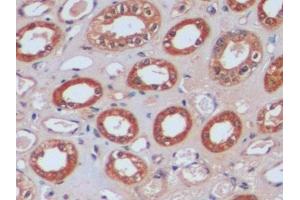 Detection of IDH1 in Human Kidney Tissue using Polyclonal Antibody to Isocitrate Dehydrogenase 1, Soluble (IDH1) (IDH1 antibody  (AA 74-333))
