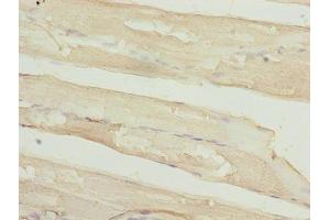 Immunohistochemistry of paraffin-embedded human skeletal muscle tissue using ABIN7159481 at dilution of 1:100 (TIMP1 antibody  (AA 24-207))