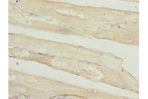 Immunohistochemistry of paraffin-embedded human skeletal muscle tissue using ABIN7159481 at dilution of 1:100