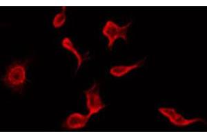ABIN6272297 staining HepG2 by IF/ICC. (RIMKLB antibody  (Internal Region))