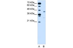 GPR161 antibody used at 2 ug/ml to detect target protein. (GPR161 antibody  (Middle Region))