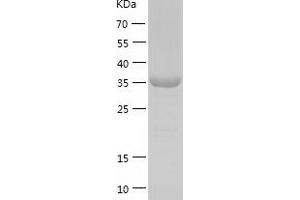 Western Blotting (WB) image for ISL LIM Homeobox 1 (ISL1) (AA 2-349) protein (His tag) (ABIN7286652) (ISL1 Protein (AA 2-349) (His tag))