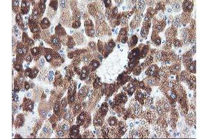 Immunohistochemical staining of paraffin-embedded Human liver tissue using anti-CYP1A2 mouse monoclonal antibody. (CYP1A2 antibody)