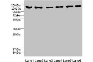 Western blot All lanes: CD1C antibody at 4. (ADGRG6 (AA 40-300) antibody)